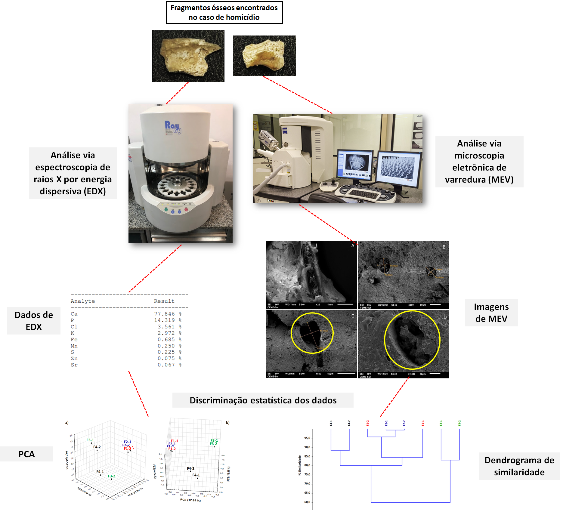 IDENTIFICAÇÃO E PROVENIÊNCIA DE FRAGMENTOS METÁLICOS ENCONTRADOS EM CRÂNIO HUMANO VIA ESPECTROSCOPIA DE RAIOS -X POR ENERGIA DISPERSIVA (EDX)